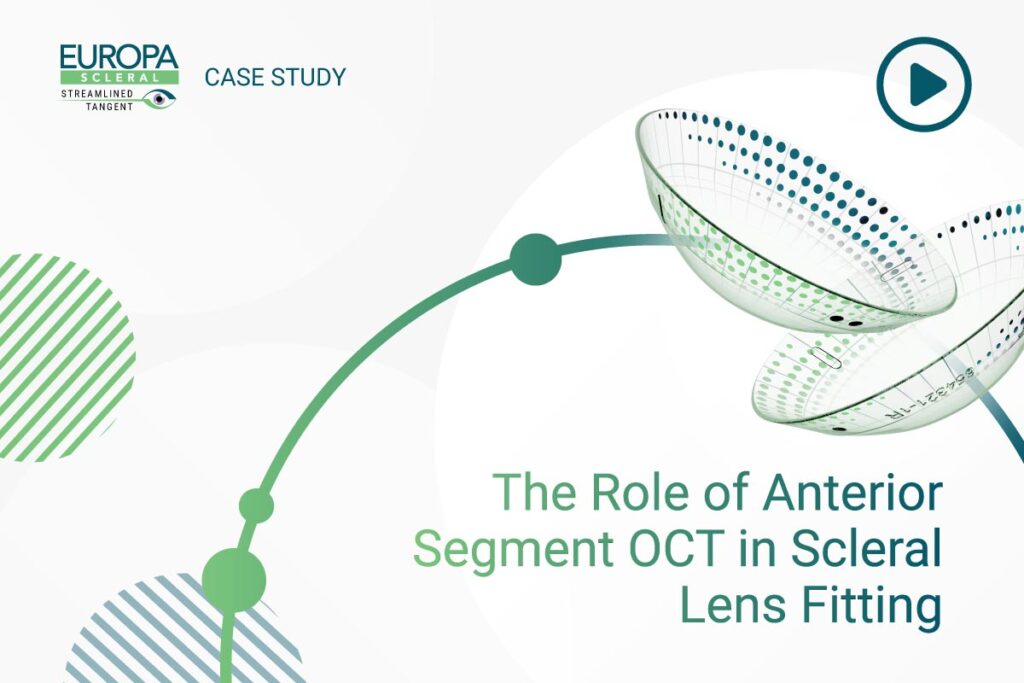 Case Study: The Role of Anterior Segment OCT in Scleral Lens Fitting